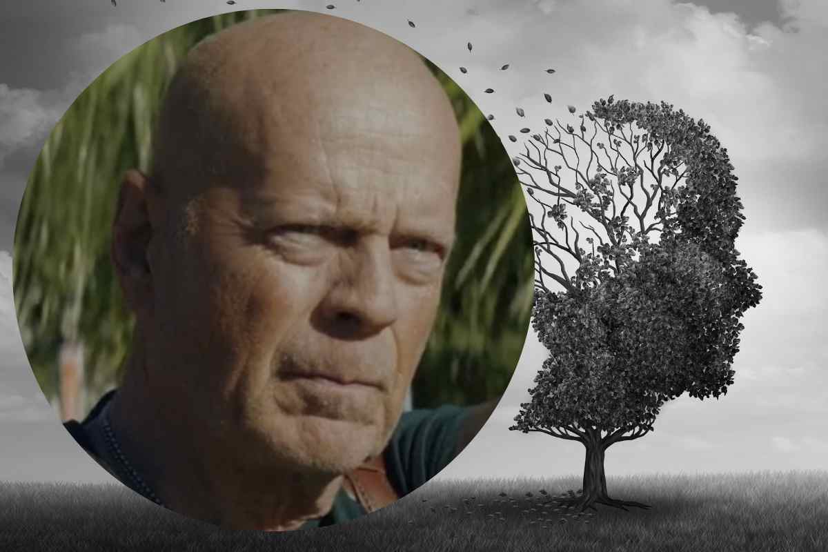 Bruce Willis e l'immagine grafica di un cervello in dissoluzione